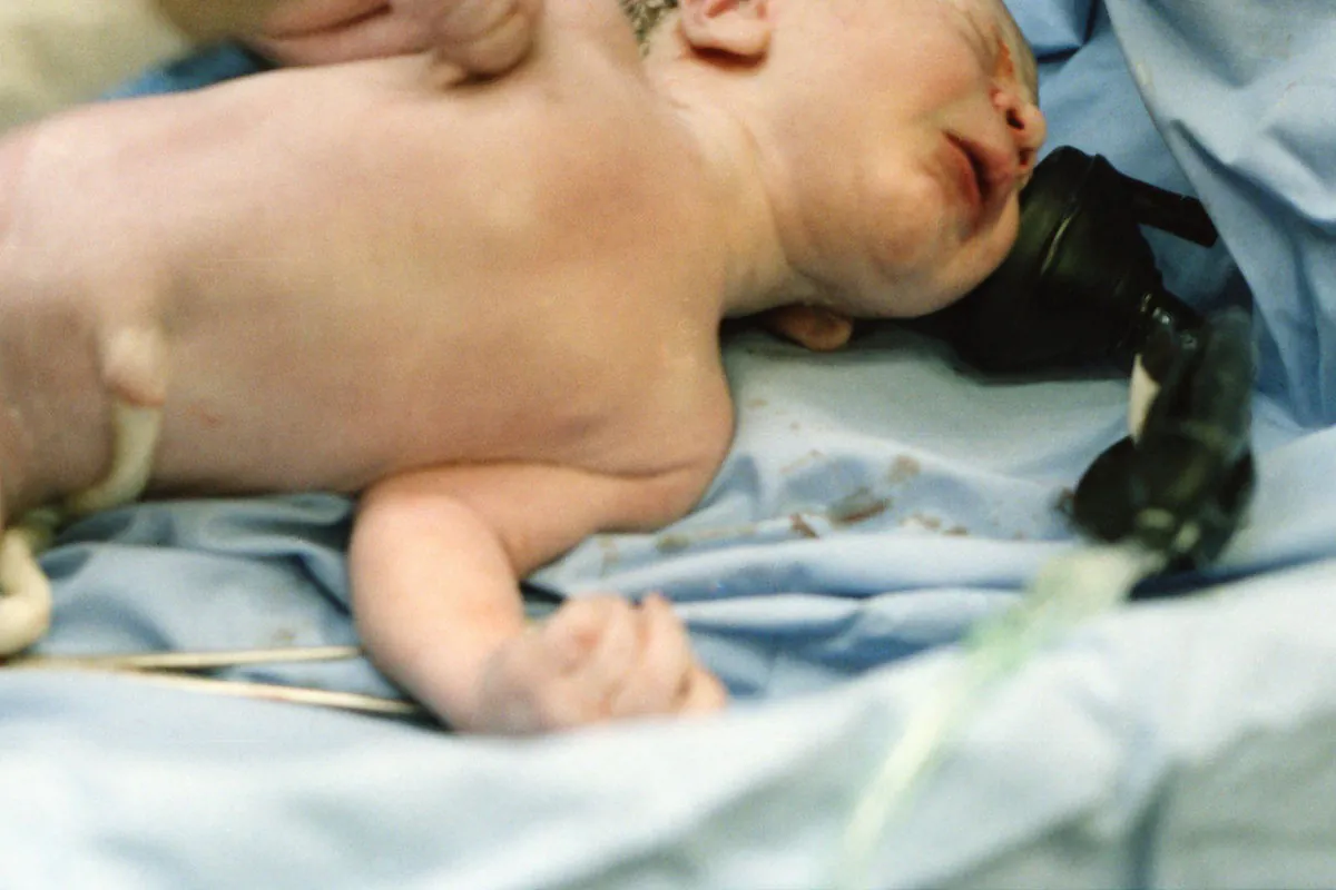 Birth Injury in Lower Merion PA