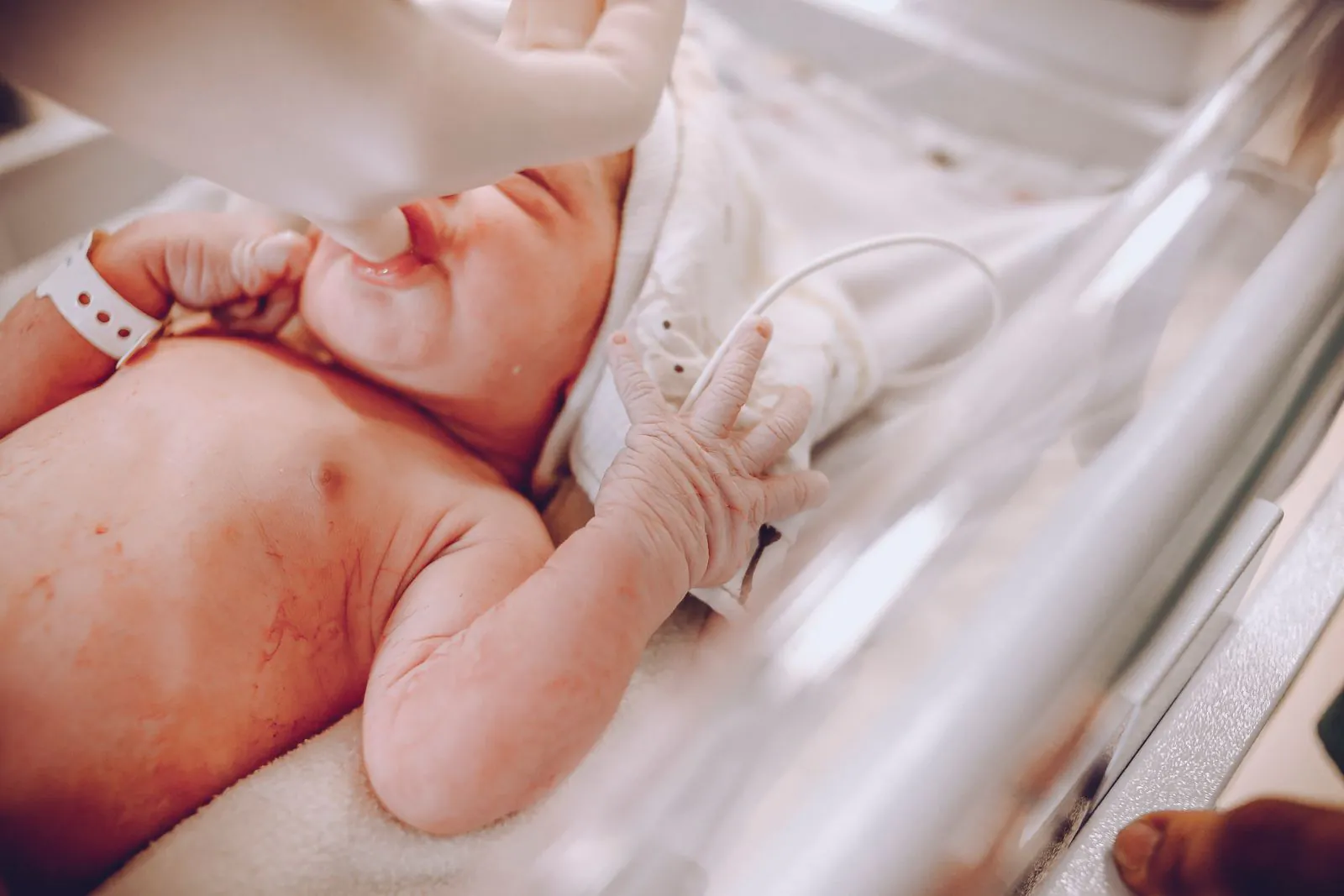 Newborn baby receiving care in a hospital setting